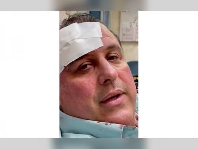 Deputy director of Ampyme was injured in attempted assault
