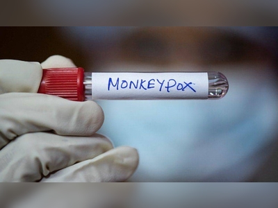 Kerala confirms India's first monkeypox death