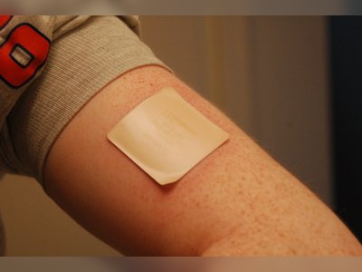 Innovative Patch Developed to Prevent Pain during Vaccine Injections